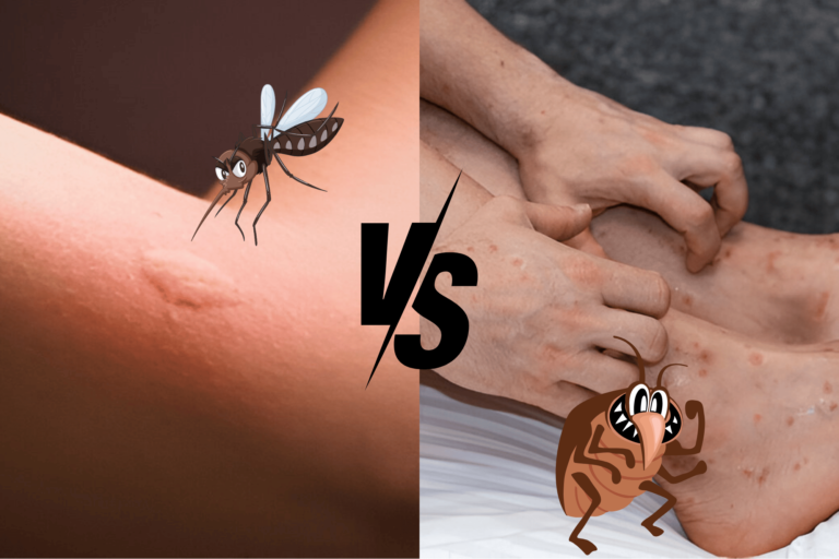 Mosquito Bites vs Bed Bug Bites: How to Tell the Difference