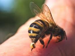 What to Put on Bee Sting