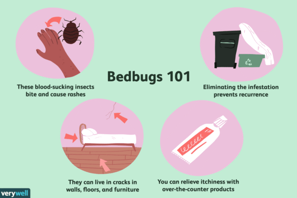 Anti Itch Remedies for Bed Bugs: Fast Relief for Bites Anti Itch Remedies for Bed Bugs