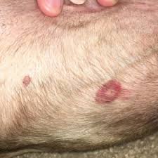 Bed Bug Bites on Pets