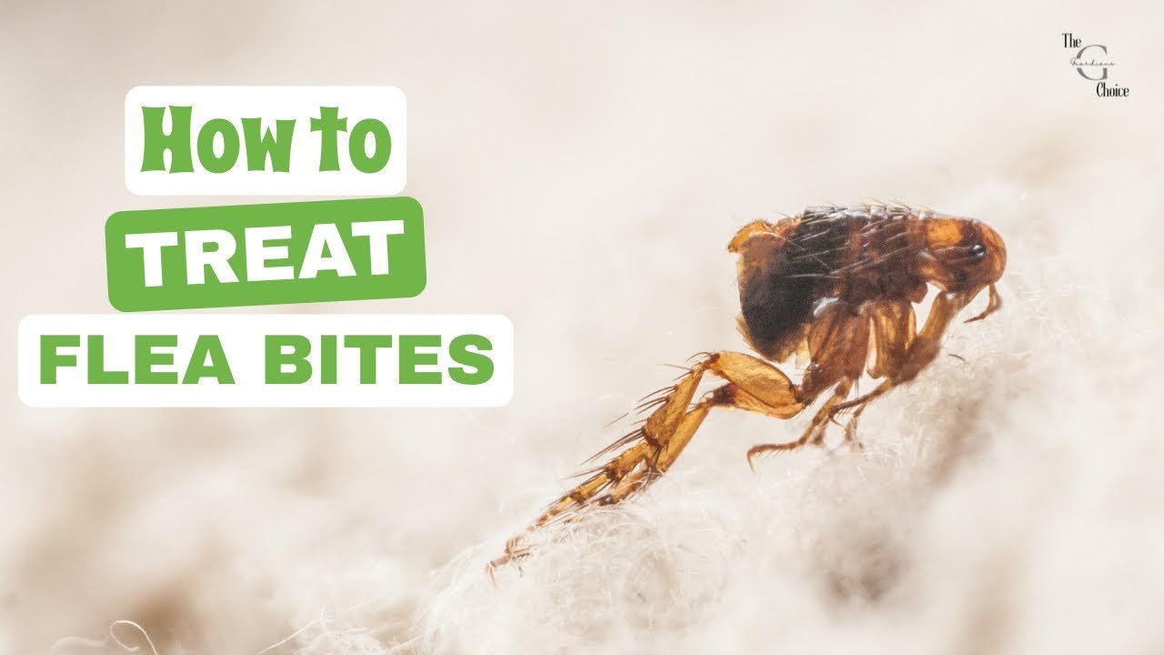 Effective Flea Bite Treatment at Home