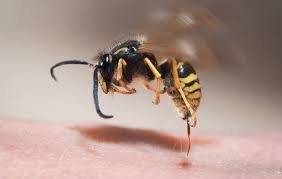 How Long Does Wasp Sting Pain Last