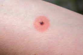 How to Know if Tick is Infected