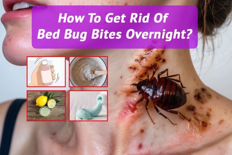 How to Soothe Bed Bug Bites Fast