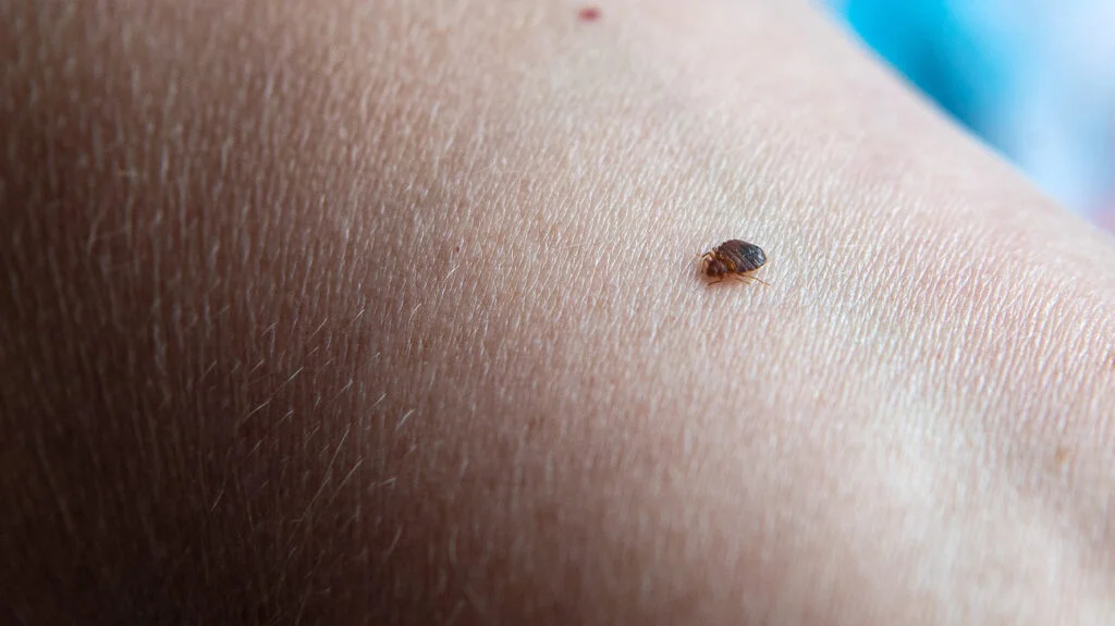 How to Tell If Bites Are From Bed Bugs