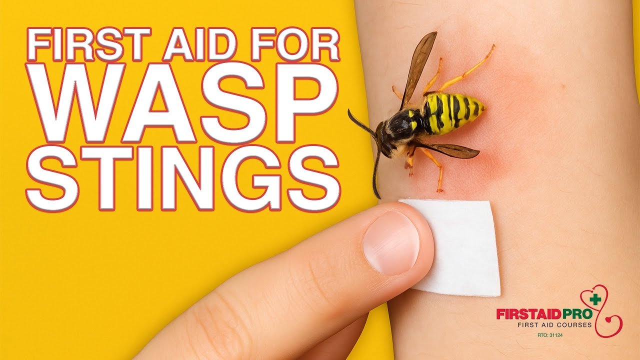 How to Treat a Wasp Sting