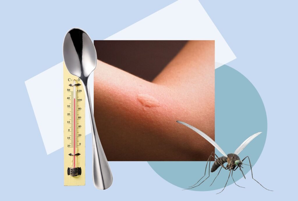 Ice or Heat for Mosquito Bites: Which Works Best for Itch and Swelling? Ice or Heat for Mosquito Bites
