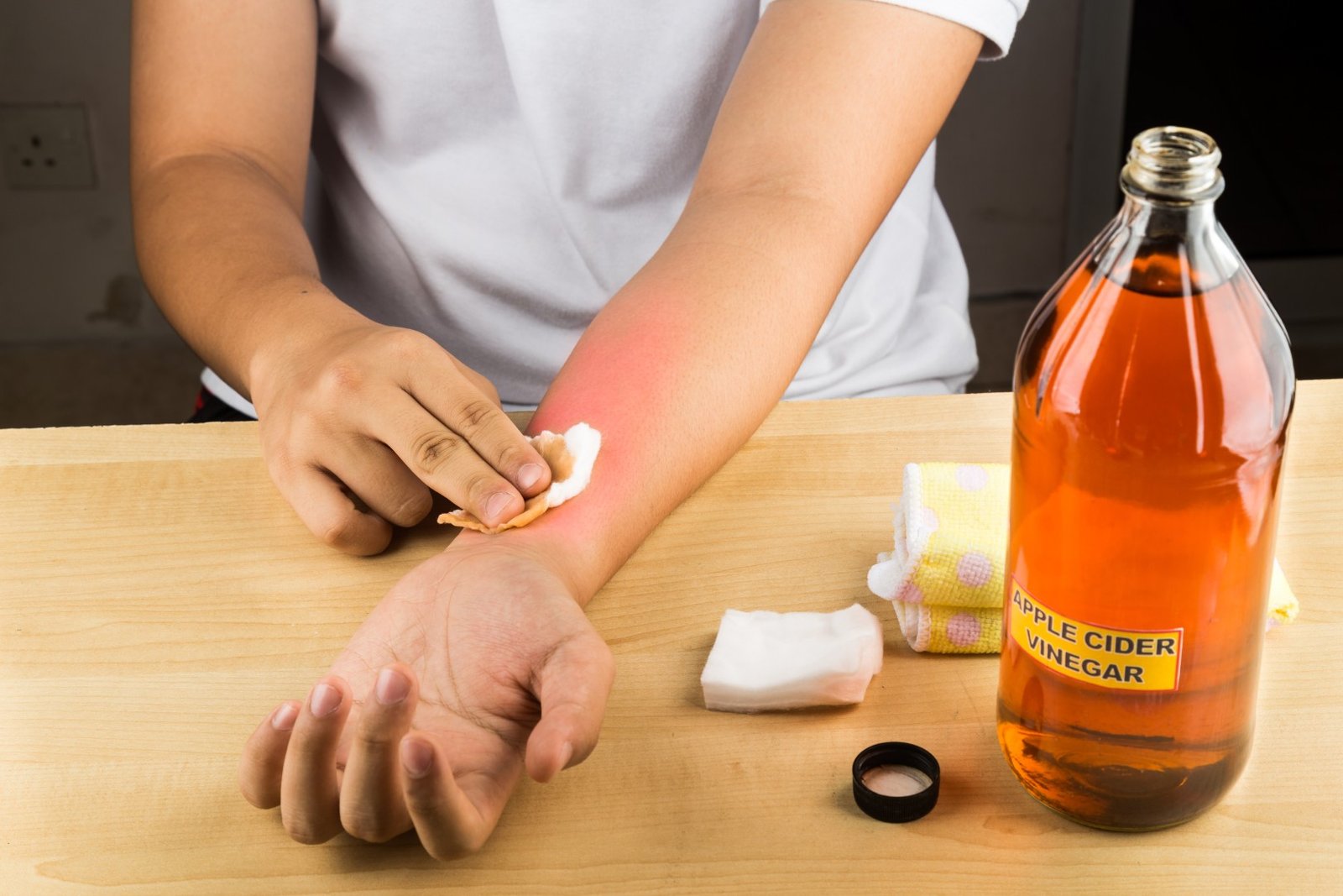 Itching Relief Natural Solutions