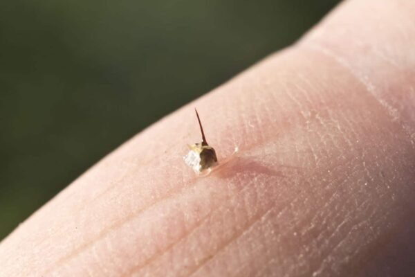 Wasp Sting and Antihistamines