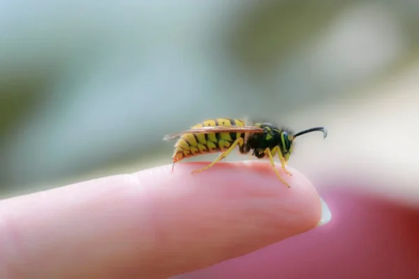 What to Apply on Wasp Sting