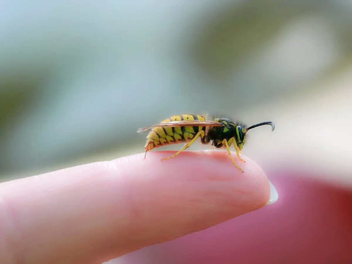 What to Apply on Wasp Sting