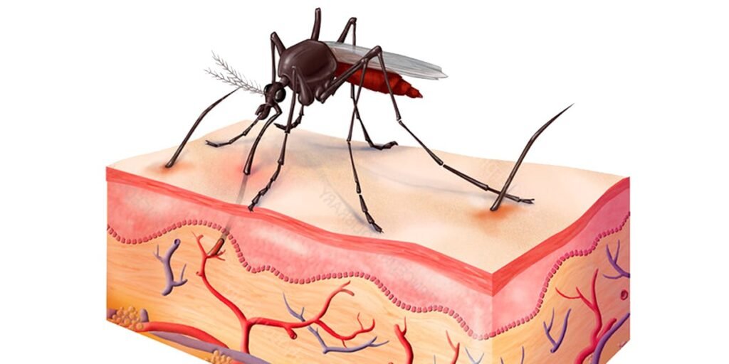 Why Do Mosquito Bites Itch? The Science Behind the Scratch Why Do Mosquito Bites Itch