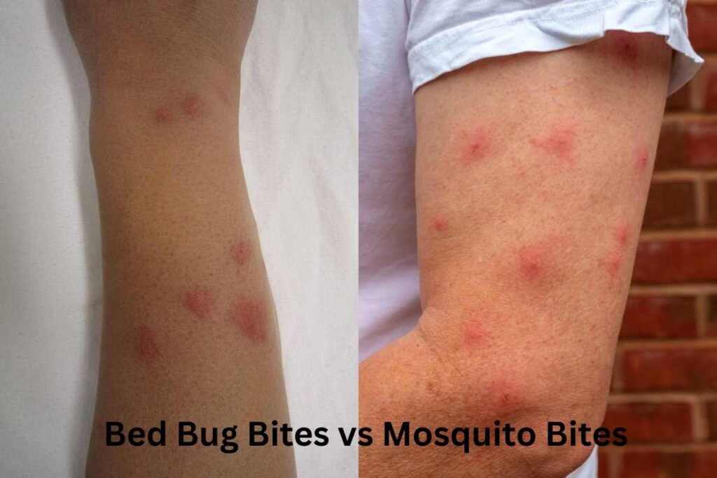 How to Identify Bed Bug Bites vs Mosquito Bites: Key Differences Explained How to Identify Bed Bug Bites vs Mosquito Bites