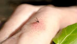 Best Antihistamine for Mosquito Bites