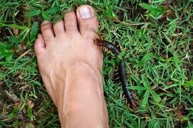 Centipede Bite Symptoms: Identification, Treatment & Recovery Guide Centipede Bite Symptoms