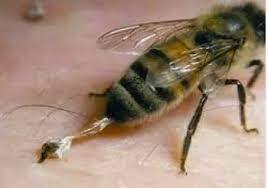 EpiPen for Bee Stings: When and How to Use It Safely EpiPen for Bee Stings