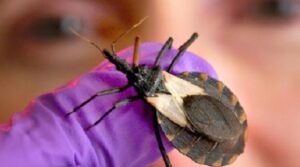 Kissing Bug Bite & Chagas Disease: Symptoms, Pictures, and Prevention Guide Kissing Bug Bite & Chagas Disease
