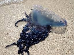 Portuguese Man O' War Sting Treatment