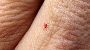 Chigger Bites vs Mosquito Bites: How to Tell the Difference and Treat Them Chigger Bites vs Mosquito Bites