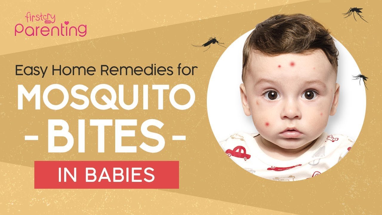 What Can I Put on My Baby’s Mosquito Bite