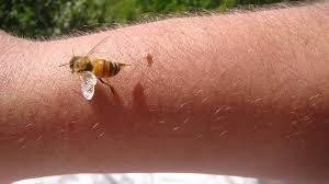 How to Reduce Bee Sting Swelling Fast: 5 Proven Home Remedies Close-up of a bee stinger in the skin.