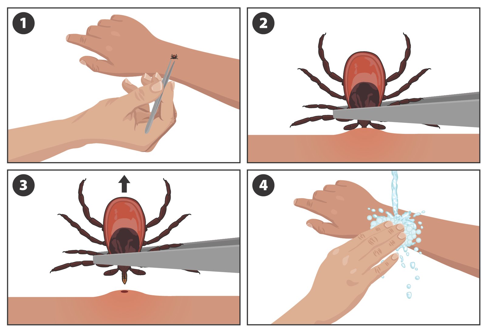 CDC diagram of removing an attached tick by grasping close to the skin with fine-tipped tweezers.