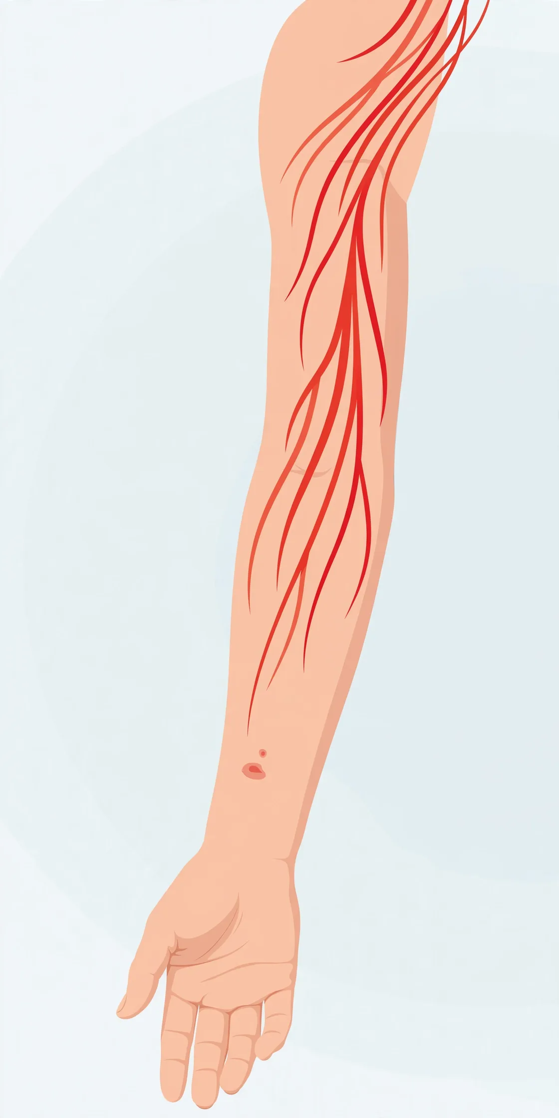 Bug Bite Abscess vs Cellulitis: Differences - illustration 3